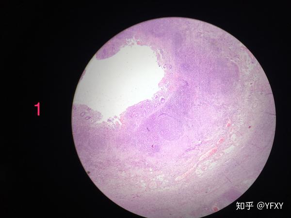 病理学 红蓝铅笔绘图