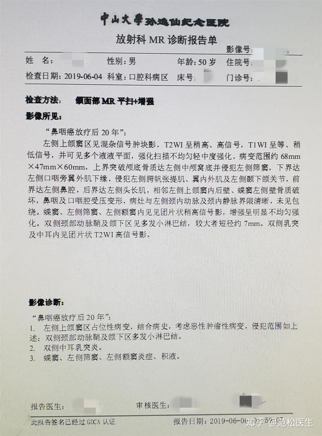 患者20年前于外院诊断为鼻咽癌,并行放疗,化疗(具体不详,1个月前出现