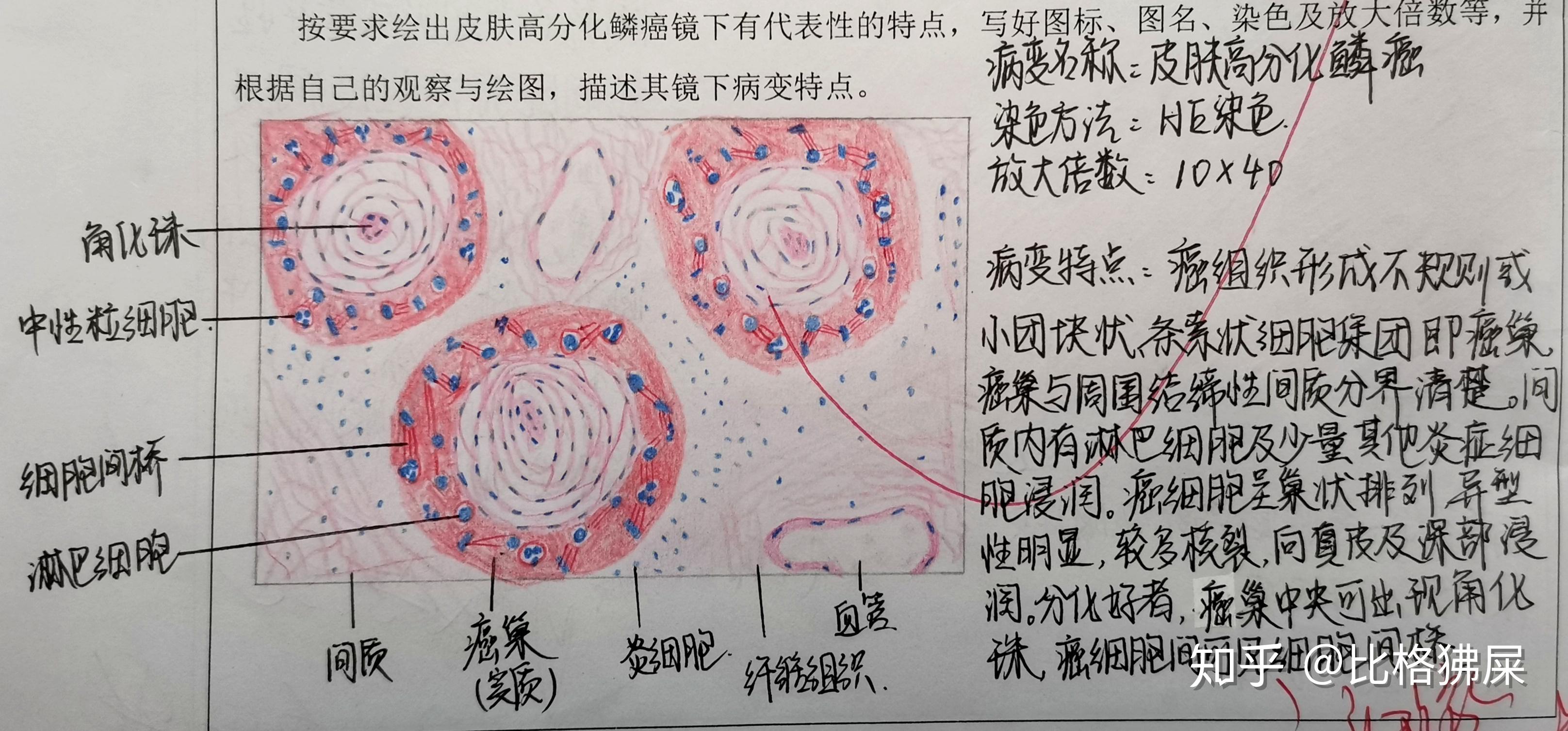 病理学实验红蓝铅笔图