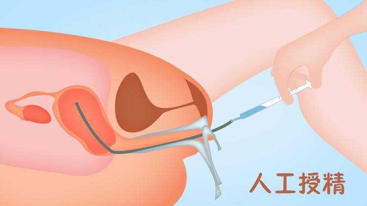 怎么回事呢,根本说不清,接下来,我们就一起来跟大家了解一下人工授精