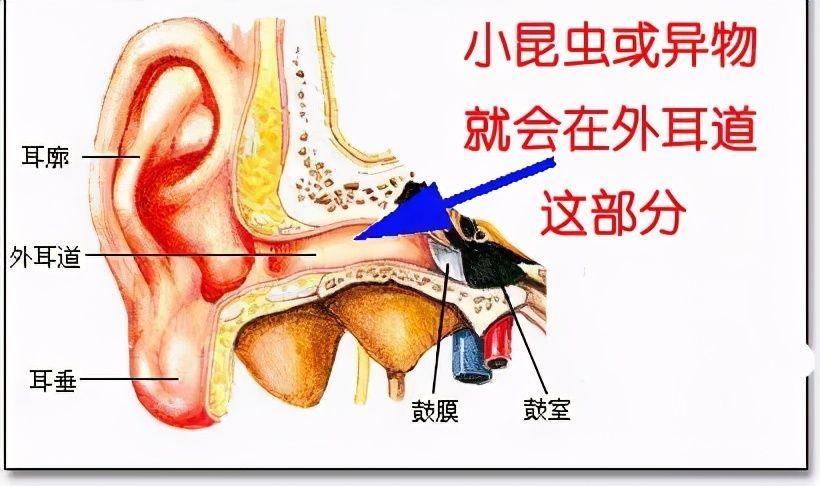 孩子耳朵进了异物别慌看这里