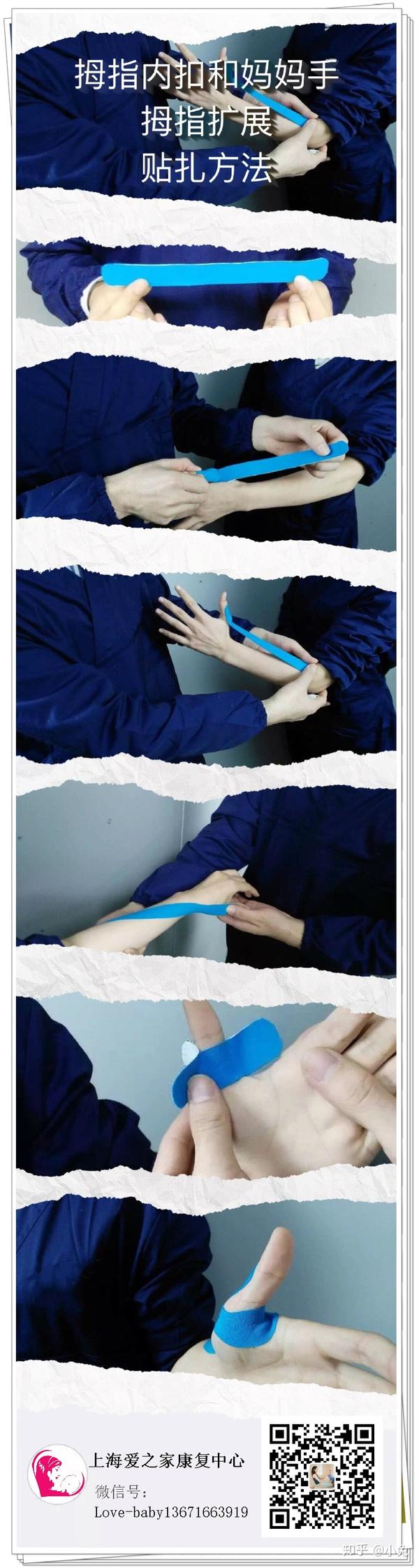 拇指内扣及外展的贴扎方法---上海爱之家儿童康复中心