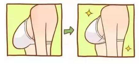 首先,我们先要知道它的定义:乳房下垂是指乳房在合理情形下,尤其是