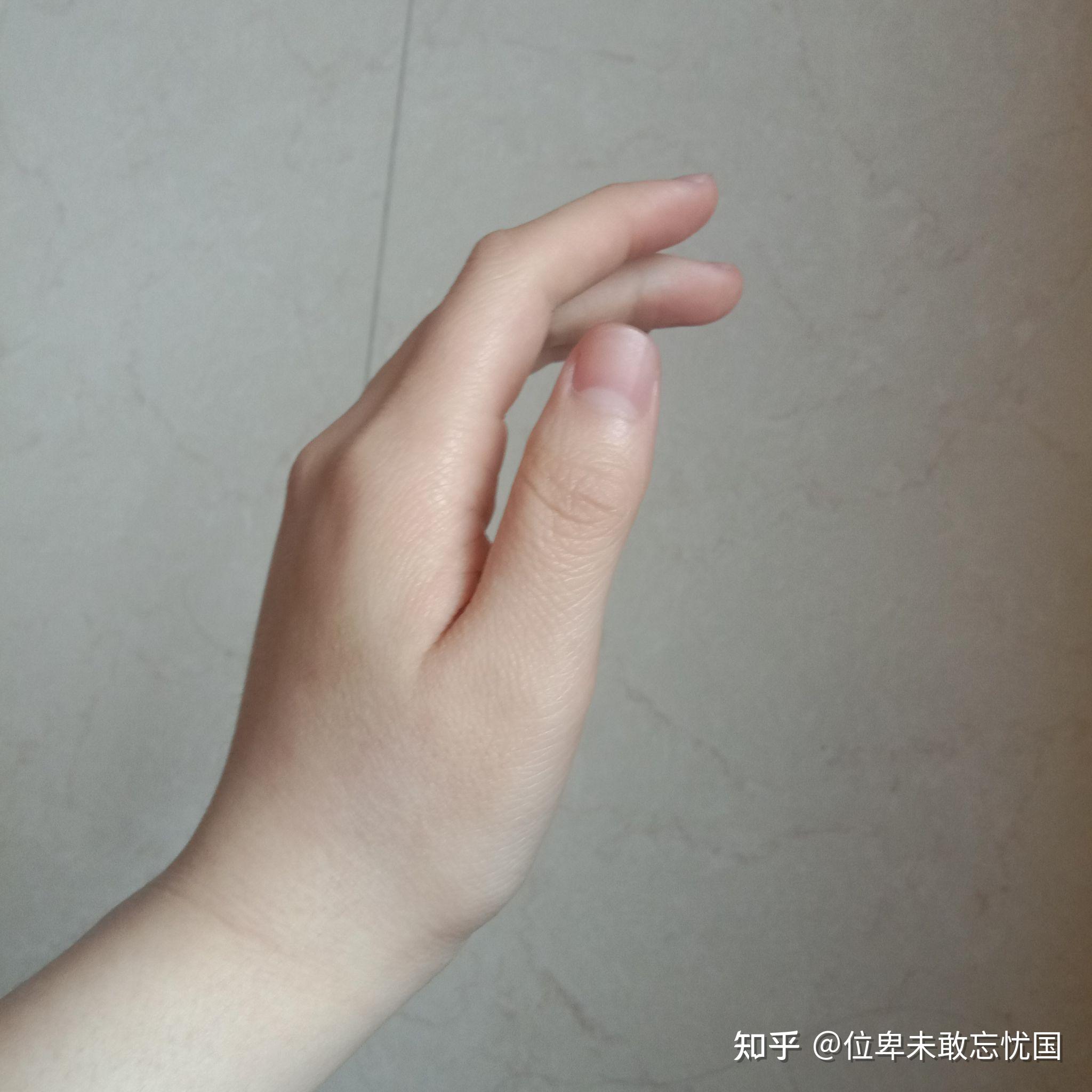 女孩子长了一双特别难看的手是什么感觉