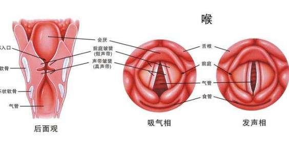慢性咽炎?原来是食管胃粘膜异位症在作怪!