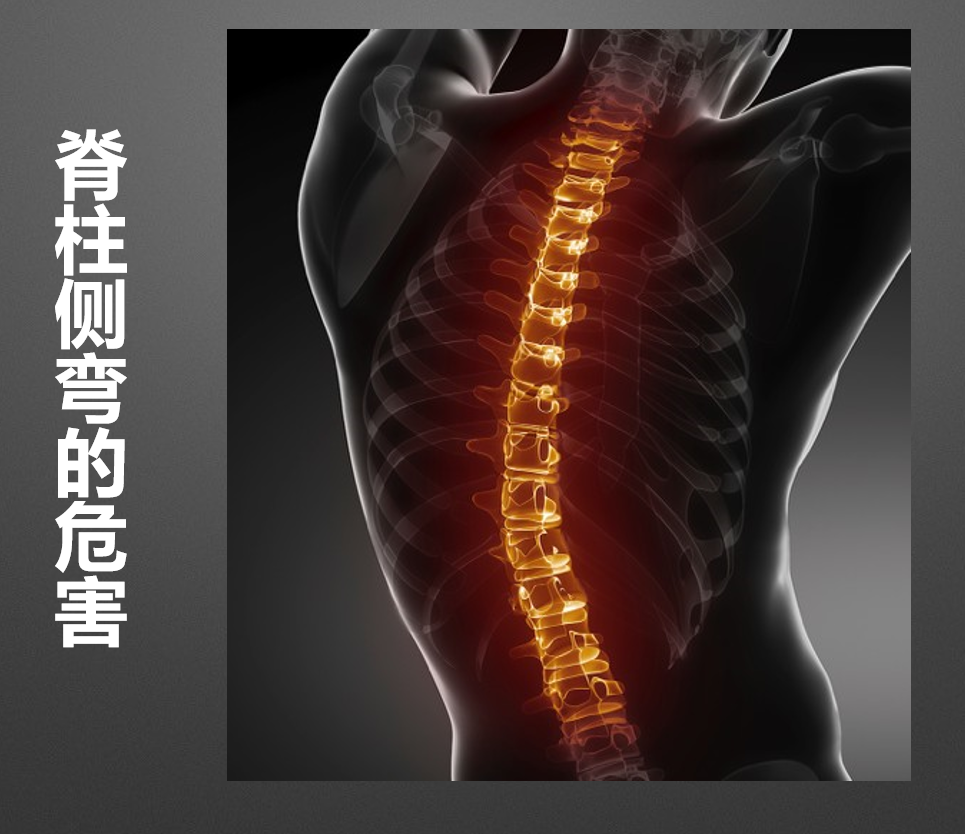 脊柱侧弯的危害