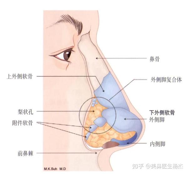 细说耳软骨仿生隆鼻
