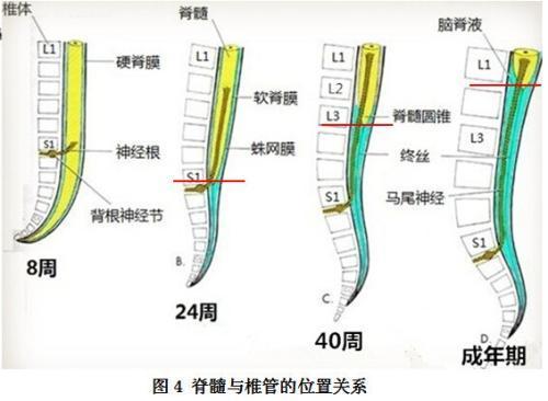 脊髓圆锥综合征和马尾神经综合征是什么关系怎么区分这两种疾病