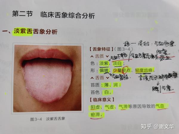 舌象的综合分析(一)
