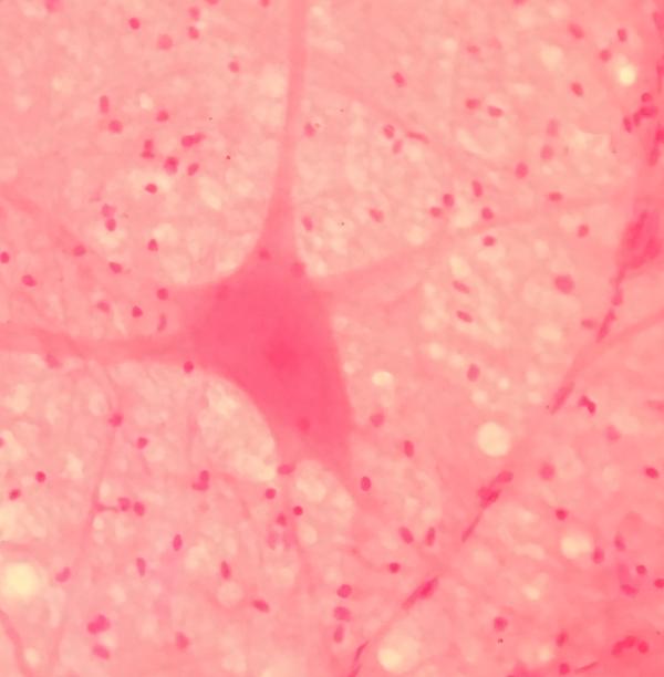 神经组织的切片,中央的大细胞为神经元细胞.图/维基百科