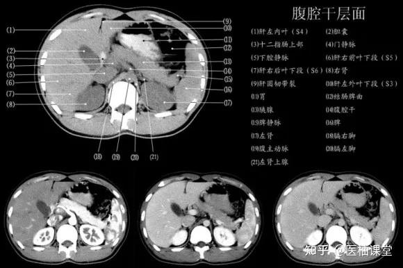 经典1小时读懂腹部ct