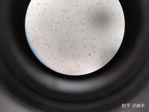 显微镜下的大肠杆菌是什么样子的呢?很可爱呢!