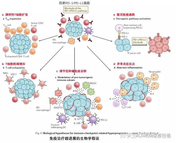 导致免疫抑制的肿瘤微环境