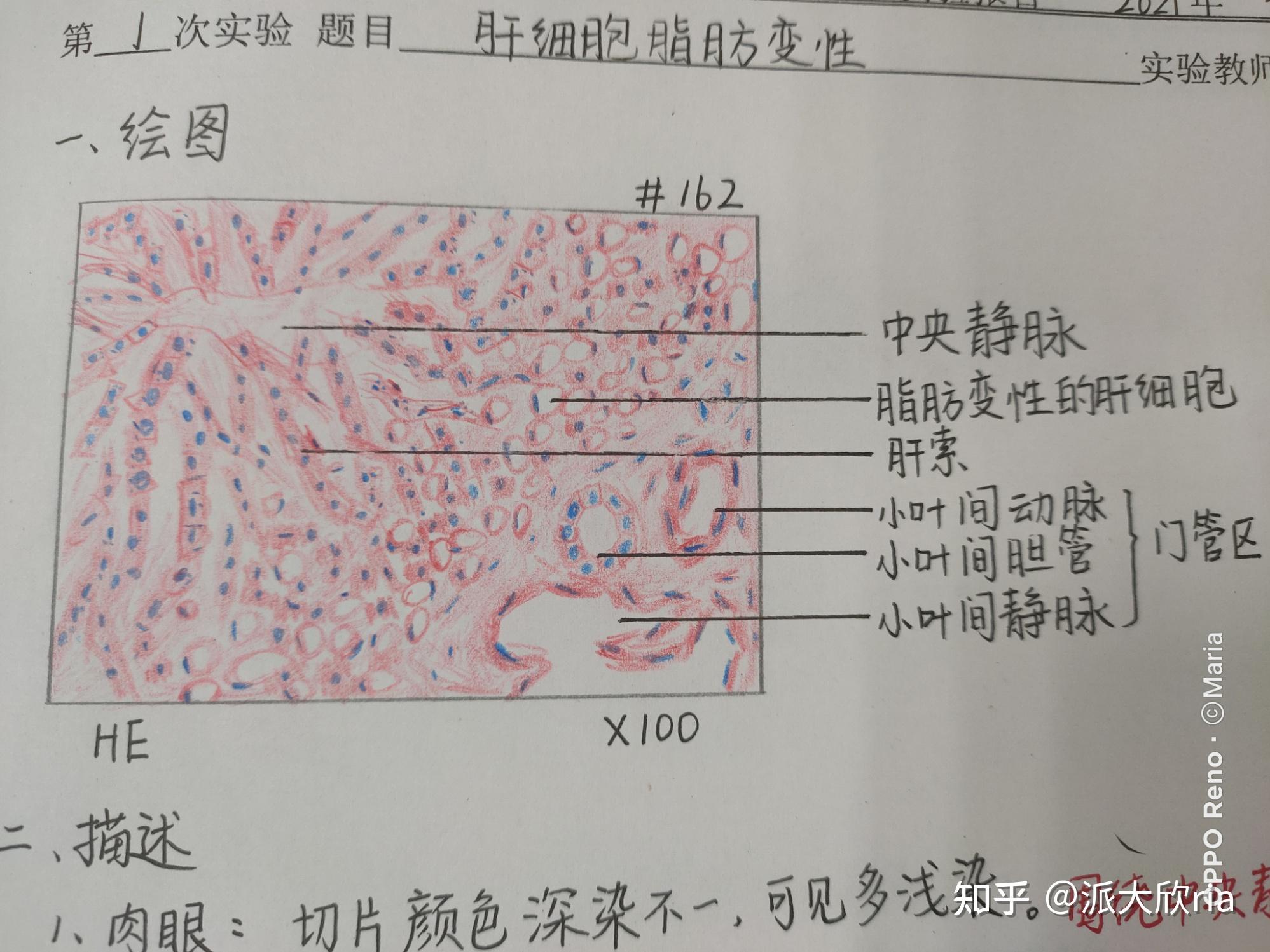 病理学实验报告红蓝铅笔手绘图有老师批改