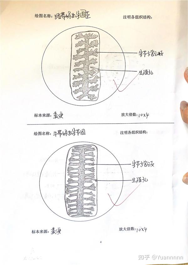 钩虫卵,旋毛虫囊包幼虫