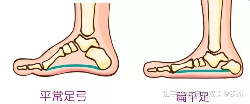 如何提高自己的足弓