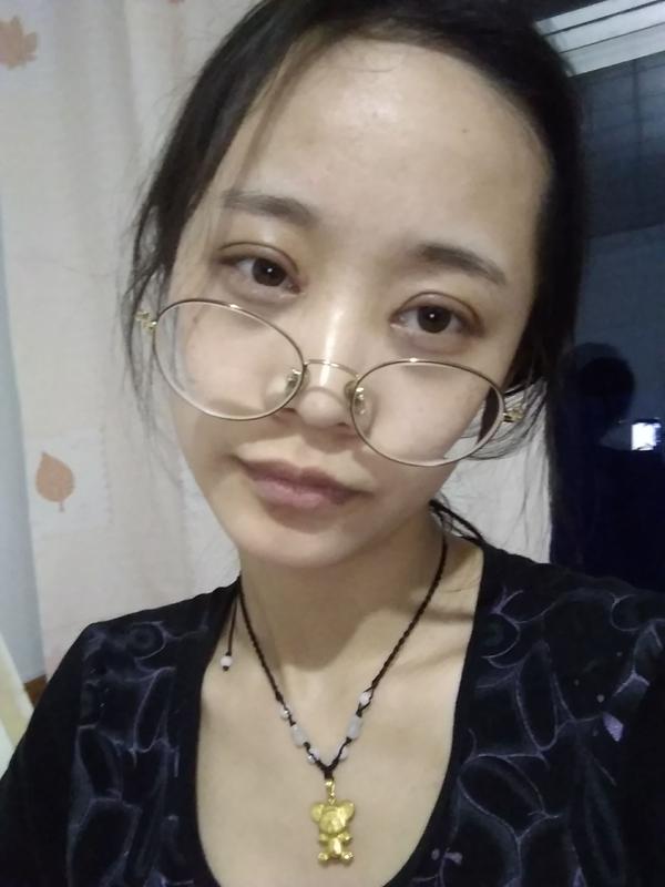 双眼皮 全切6mm&开眼角
