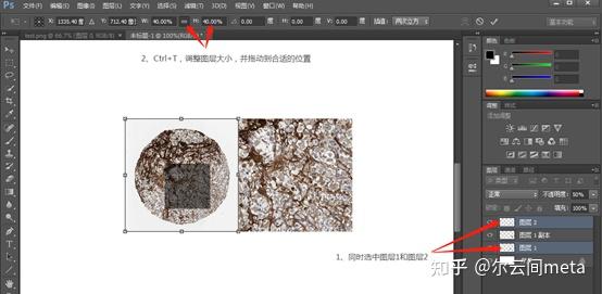 人类高质量科研图片生信sci免疫组化细节放大图绘制手把手教会你