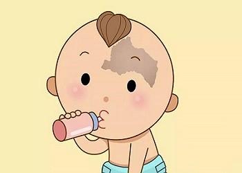 婴儿胎记一直长大是什么情况