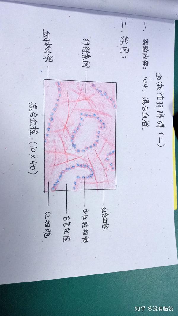 病理学红蓝铅笔绘图