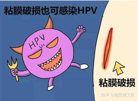hpv病毒的传播途径一般有三种,最常见的是通过性行为传播,其次是间接