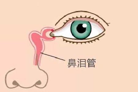 首大陈潜如何治疗鼻泪管阻塞