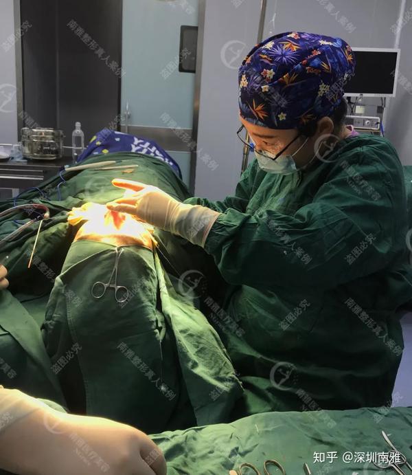 硅胶假体 医生在术中还会多角度观察,微调鼻部的整体形态,实现各个