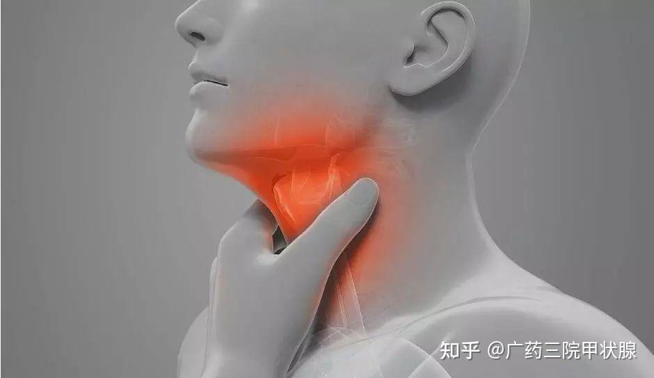 你以为的咽喉痛可能是甲状腺疼痛