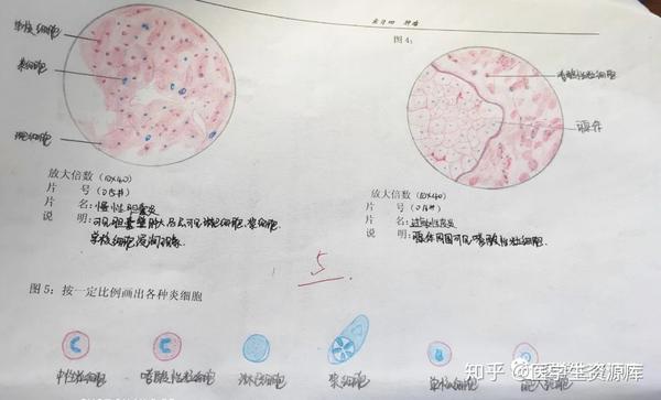 病理切片红蓝铅笔手绘图