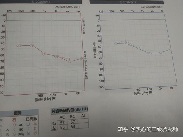 如何看懂纯音听力图?