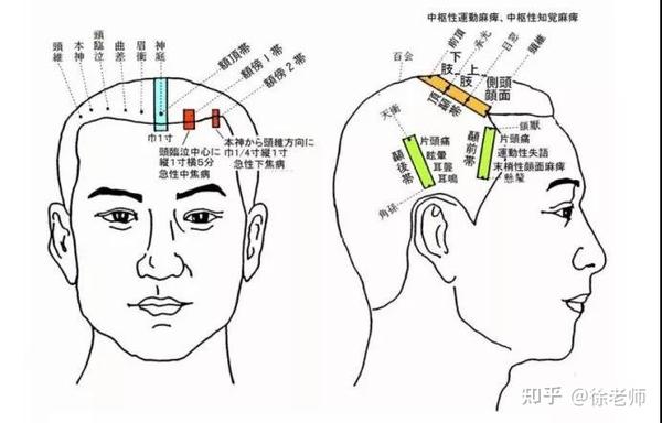 收藏这张人体全息图穴位不用找