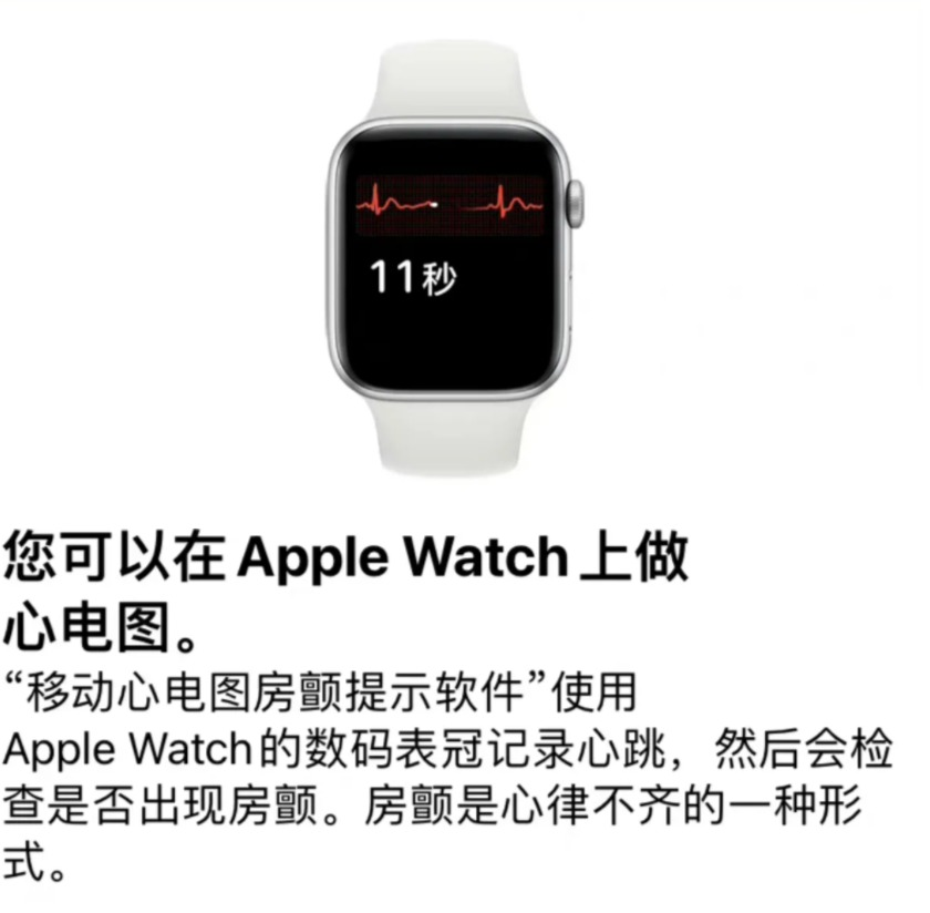 如何评价国行applewatch支持心电图功能它对我们的日常生活真的有用吗