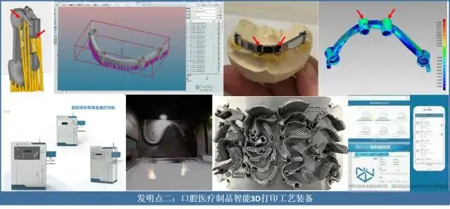 发明点二:口腔医疗制品智能3d打印工艺装备