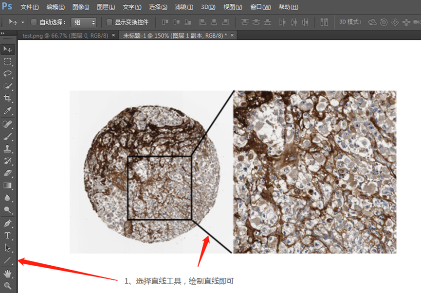 人类高质量科研图片生信sci免疫组化细节放大图绘制手把手教会你