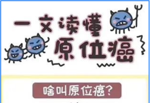 什么是原位癌图文介绍清晰易懂