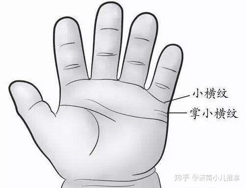 操作:揉掌小横纹,以食指或中指揉之.