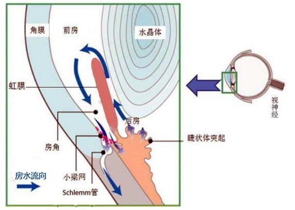 近视发生和发展的新学说房水理论