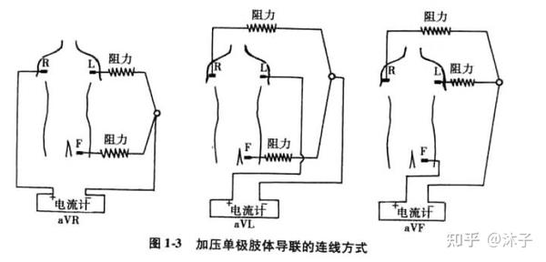 心电图之12导联介绍整理