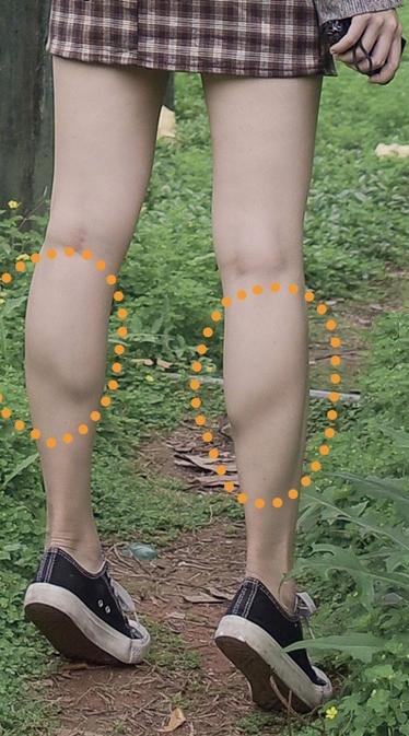 女生肌肉腿真的瘦不了吗?