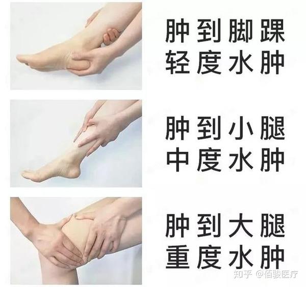 肾友注意:肾脏"求救"的9个信号,远离尿毒症!及时预防