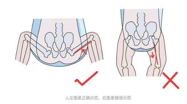 向髋关节发育不良sayno抱抱熊腰凳正式获得国际髋关节协会认证