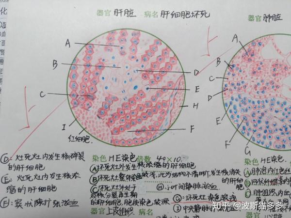 兽医病理解剖学组织切片红蓝铅画图展示