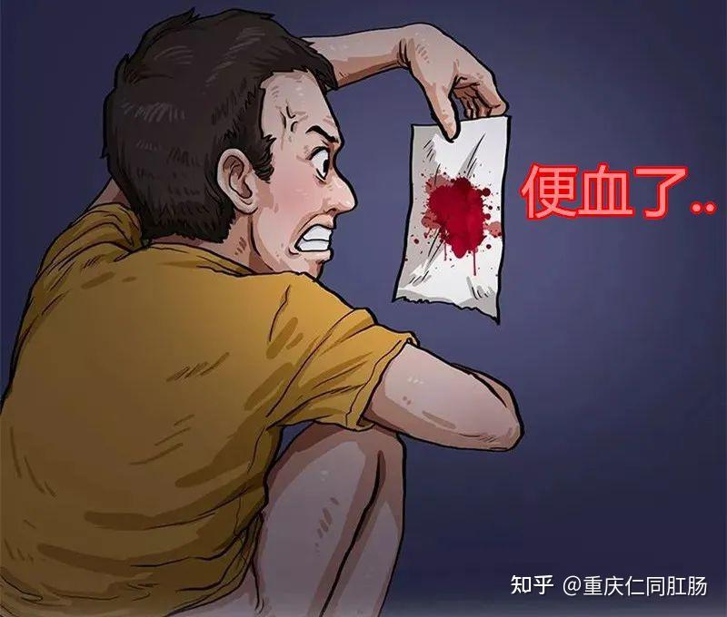 痔疮出血严重吗 zhuanlan.zhihu.com