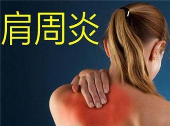 针灸治疗肩周炎选用肩髃,肩髎,肩贞,这三穴是如何发挥