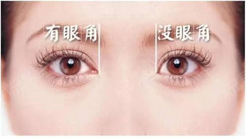什么样的人适合开眼角