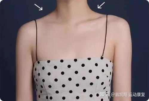 体态界的内卷也开始了快来看看如何改善两侧锁骨不对称吧
