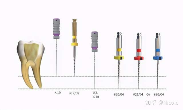 下颌尖牙的双根管结构及预备方法