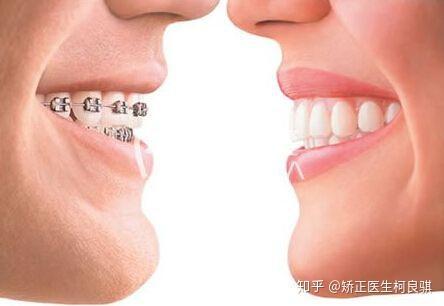牙齿矫正的周期跟哪些因素有关?