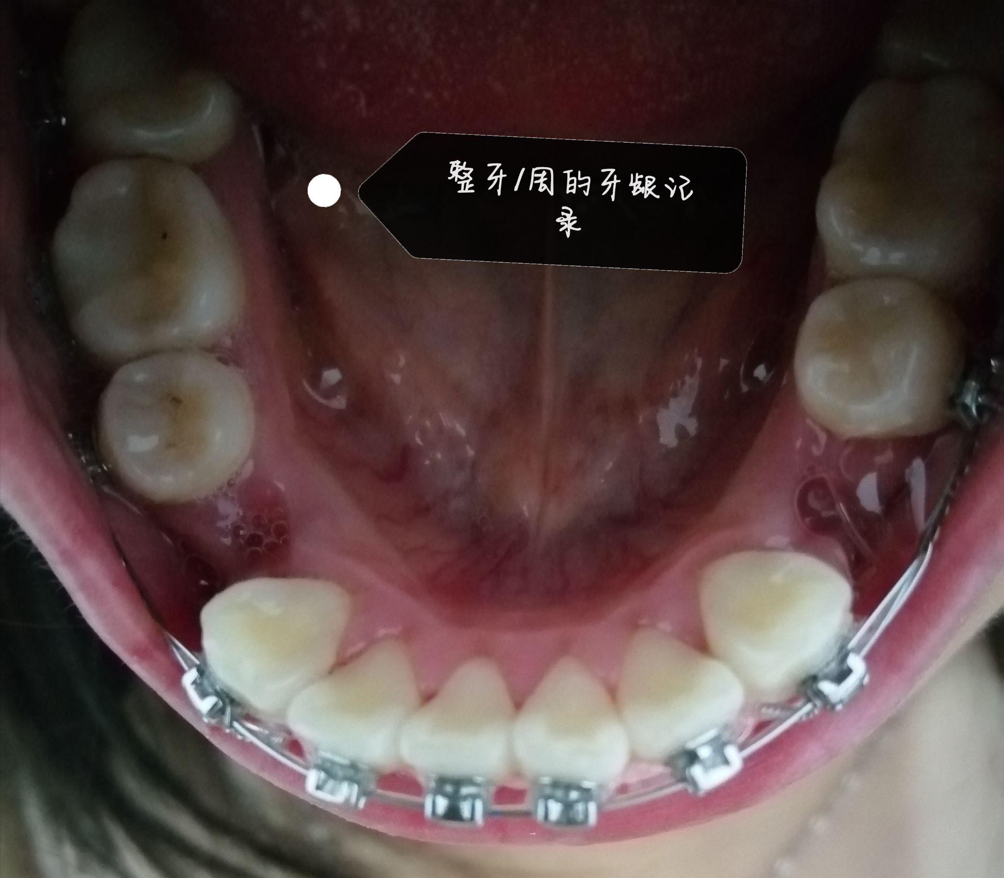 骨性牙突的改变地点常州北极星口腔钟楼区分院