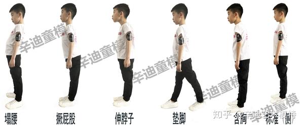 2,侧面观 观察孩子是否骨盆前后倾,颈前倾,青蛙肚,膝盖超伸等.
